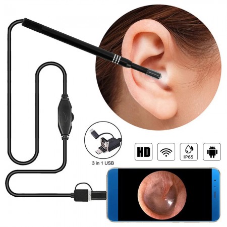 Camera Earwax Removal Kit